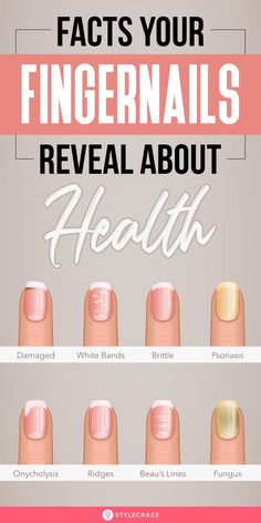 Nail Problems, Health Signs, Tongue Health, Nail Care Tips, Brittle Nails, Striped Nails, Nail Fungus, Nail Health, Yellow Nails