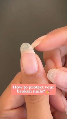 Broken Nails, Nail Polish Art, How To Protect Yourself, Today Only