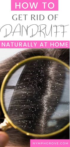 If you want to get rid of dandruff quickly, try these DIY dandruff remedies and hair hacks and haircare tips. | dandruff home remedies, dandruff remedy DIY, how to get rid of dandruff fast at home, how to get rid of dandruff naturally, how to get rid of dandruff permanently, how to get rid of dandruff overnight, DIY dandruff treatment, DIY dandruff shampoo, DIY dandruff hair mask, hair treatments, healthy hair, natural haircare tips | Best Anti Dandruff Shampoo, Home Remedies For Dandruff, Rid Of Dandruff, Dandruff Hair, Dandruff Remedy, Getting Rid Of Dandruff