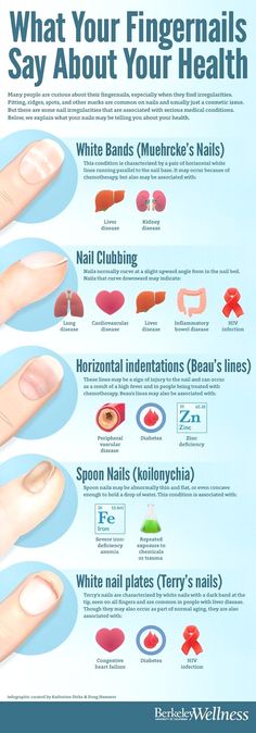 Fingernail Health, Tongue Health, Avocado Smoothie, Mental Training, Nail Health, Health Info, Health Facts, Medical Conditions, Body Health