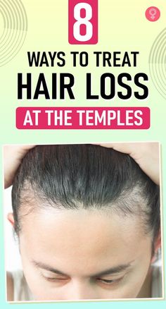 8 Ways To Treat Hair Loss At The Temples: Temple hair loss is commonly seen in women, and coping with it might not be easy. Recognizing hair loss and its reasons can help you find a remedy. Continue reading to learn what triggers hair loss at the temples and how to restore temple hair effectively. #hairloss #haircare #haircaretips Hair Shedding Remedies, Natural Hair Growth Remedies, Herbs For Hair, Hair Growth Supplement