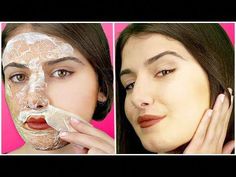 Learn how to remove facial hair with this diy facial hair removal treatment . This tutorial for facial hair removal at home will remove all unwanted hair eas... Homemade Hair Removal, Diy Facial Hair Removal, Waxing Vs Shaving, To Remove Facial Hair, Flat Tummy Tips, Hair Removal Diy, At Home Hair Removal