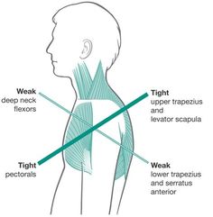 Scapula Exercises, Upper Cross Syndrome, Fix Rounded Shoulders, Posture Fix, Shoulder Impingement, Bolesti Chrbta, Pelvic Floor Dysfunction, Posture Exercises, Hand Therapy