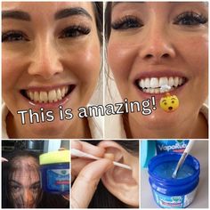 Vics Vapor Rub, Vicks Rub, Vaporub Uses, Teeth Whitening Diy