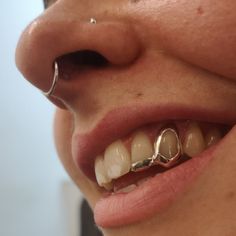 a close up of a person's mouth with braces