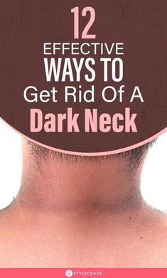 Read about the 12 most effective home remedies and tips to get rid of a dark neck, including foods, oils and spices, natural remedies, and skin care treatments. Dark Skin Around Neck, Natural Sleep Remedies, Face Wrinkles, Natural Cough Remedies, Sleep Schedule