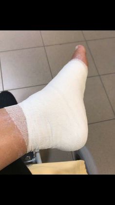 a person with a cast on their foot sitting in a chair next to a tile floor