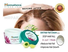 hamaliyaanti hair fall cream Anti Hair Fall, Improve Hair Growth, Reduce Hair Fall, Hair Fall, Fall Hair, Hair Growth, How To Use, Cream, Hair