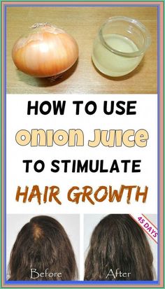 Can Onion Juice Stop Hair Loss by betty Hall | This newsletter was created with Smore, an online tool for creating beautiful newsletters for educators, nonprofits, businesses and more Still Waiting For You, Onion Juice, Baking Soda Cleaning, Health Signs, Stimulate Hair Growth, Still Waiting, Avocado Salad, Hair Health, Health Remedies