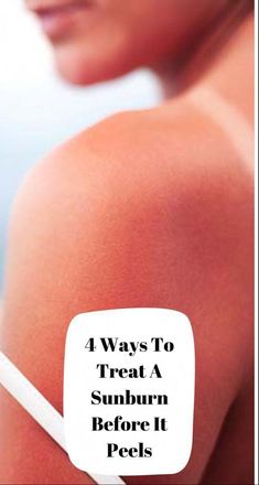 Say Goodbye To Sunburn Peeling Forever!Say Goodbye To Sunburn Peeling Forever! Bad Sunburn, Natural Face Care, Sun Burn, Perfect Skin Care Routine, Peeling Skin