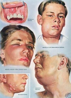 an old poster shows the stages of facial changes in men's heads and mouths