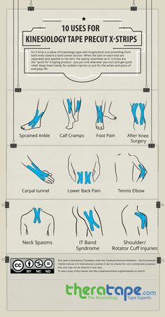 Kt Tape Volleyball, Neck Spasms, Pnf Stretching, Physio Tape, K Tape, Psoas Release, Calf Cramps, Kinesio Tape, Kt Tape