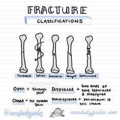 an image of different types of bones in the text description for each type of bone