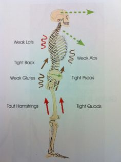 Muscle imbalances Lower Cross Syndrome, Psoas Release, Yoga Anatomy, Muscle Imbalance, Spine Health, Muscle Anatomy, Medical Anatomy, Yoga Therapy, Back Pain Exercises