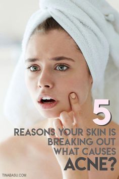 Acne is a skin condition that affects almost everyone at some point in life. It’s important to understand what causes acne to tackle it better. Here are 6 reasons.. your skin might be breaking out. How To Stop Breaking Out On Face, What Causes Acne, Back Pimples, Skin Breaking Out, Face Pores