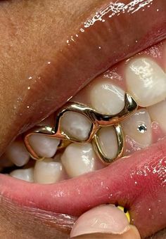 Silver Tooth Grill, Teeth Grills For Women, Grillz For Females, Teeth Gems, Pretty Teeth, Dental Jewelry, Grillz Teeth, Dope Jewelry Accessories, Tooth Gems