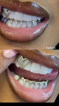 grills, gold grills inspo, gold grills girls Bottom Teeth Grills Girl, Girl Grillz Gold Grill, Piercing Needle Aesthetic, K9 Grillz Women, Grill Black Women, Gold Aesthetic Black Woman, Gold Grillz For Females, Grill Inspo Girl, Big Latto Grills