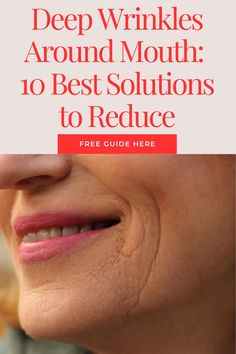 Deep Wrinkles Around Mouth: 10 Best Solutions to Reduce Wrinkles Around Mouth, Proven Skincare, Marionette Lines, Smile Lines, Anti Aging Tips, Deep Wrinkles, Youthful Skin