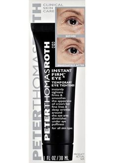 23 Eye Creams You Can Get On Amazon That People Actually Swear By Cystic Acne Remedies, Homemade Eye Cream, Natural Eye Cream, Under Eye Puffiness, Retinol Cream, Peter Thomas Roth