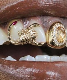 a woman's mouth with gold teeth and braces on top of her teeth