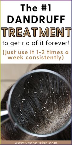 Tired of dandruff ruining your hair days? Discover the top 7 dandruff treatments that actually work to eliminate flakes and itchy scalp for good. Whether you're dealing with dry scalp or stubborn dandruff, these natural dandruff remedies and anti-dandruff shampoos will restore your scalp’s health and give you the confidence to flaunt your hair. Learn how to prevent dandruff, promote hair growth, and maintain a healthy scalp with these powerful hair care tips! How To Prevent Dandruff, Natural Remedies For Dandruff, Best Shampoo For Dandruff, How To Treat Dandruff, Wavy Hair Care