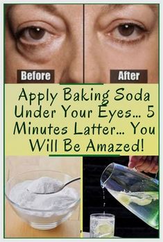 I have so much gratitude for you. Mind-blowing info! Baking Soda Coconut Oil, Baking Soda Shampoo Recipe, Baking Soda Face Mask, Baking Soda Face, Shampoo For Gray Hair, Hair Magic, Baking Soda Uses, Baking Soda Shampoo