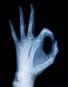 an x - ray hand is shown in the dark