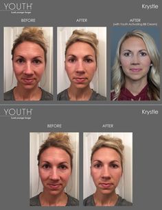 Younger Looking Skin, Look Younger, Simple Skincare, Natural Skin, Skin Care Tips, Natural Skin Care