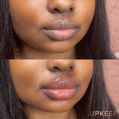 Lip filler before and after by UPKEEP Med Spa. Find more lip filler inspo and beauty aesthetics on our page or on our instagram! Book a free consult with us on our website. Lip Filler Inspiration, Filler Inspiration, 1ml Lip Filler, Doll Lips, Blush For Dark Skin, Lips Inspiration, Face Fillers, Beauty Procedures