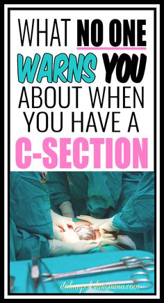 A woman having a cesarean section delivery in the operating room. Prayers For C Section Delivery, Cesarian Section, Prepare For C Section