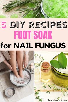 Remove Toxins Through Feet At Home, Epsom Salt Foot Soak Recipes, Toe Nail Fungus Home Remedy, Healthy Feet And Toenails, Foot Detox Soak Diy, Diy Athletes Foot Remedy, Foot Soak For Cracked Heels Diy, Foot Soak For Athletes Foot, Footsoak Diy