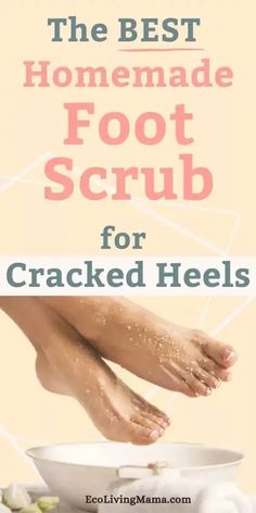 Heel Callus Remover Diy, Dry Skin On Feet Removal Diy, Foot Scrub Diy Exfoliating, Cracked Heels Diy, Diy Foot Scrub Recipes, Homemade Foot Cream, Feet Soak, Feet Scrub, Foot Scrub Recipe