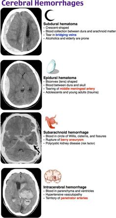 an mri scan shows the different areas of the brain and how they are related to each other