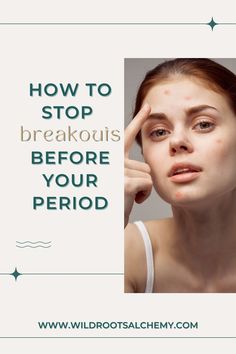 Premenstrual acne, or acne that occurs right before your period, is so common! Here are my top 8 tips for stopping those pre-period breakouts.