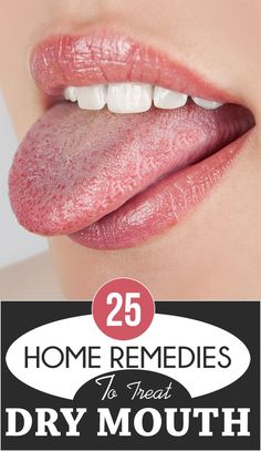 25 Effective Home Remedies To Treat Dry Mouth #homeremedies #Remedy Remedies For Dry Mouth, Snoring Remedies, Tongue Health, Dry Mouth, Holistic Remedies, Nail Health, Lose 40 Pounds, Tooth Decay, Natural Home Remedies