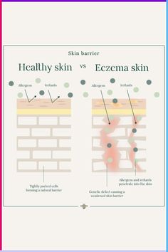 Let’s talk damaged skin barrier V.S. strong skin barrier. The skin barrier, also sometimes referred to as the “moisture barrier” or “acid mantle,” is a term used to describe the top layer of your skin. It is the outermost layer of the skin. How to treat a damaged skin barrier? 💧Use oils on the skin to help repair skin barrier and also prevent moisture loss. 💧Look for moisturizers with glycerin, hyaluronic acid, petrolatum, or glycerin. 💧Use products that are gentle with clean ingredients. Skin Physiology, Skincare Knowledge, Damaged Skin Barrier, Skin Barrier Repair, Facial Massage Techniques, Esthetician School, Cell Forms, Get Some Sleep, Product Poster