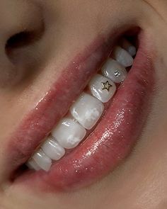 Want to cop this look? Book online now for our 18k gold charm + additional swarovski ❤️✨ #sparklebymaya #toothgem #18kgold #swarovski #stargirl Gold Teeth Jewelry, Tara Yummy Tooth Gems, Gold Teeth Gems, Star Grills Teeth, One Tooth Gem, Window Tooth Gem, Feminine Grillz, Diamond On Tooth, Silver Tooth Gem