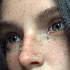 a woman with freckles on her face looking at the camera