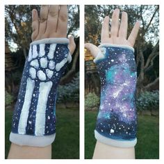 Broken Arm Cast, Cast Decoration, Cast Drawing, Arm Cast, Cast Art, Broken Arm, Picture Prompts, Drawing Tips, Its My Birthday