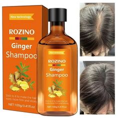 Ginger Shampoo Itch Refreshing Oil-control Dandruff Hair-fixing Shampoo 100g Features: Soothe your scalp and say goodbye to itching with our ginger shampoo, specially formulated to provide relief from discomfort. Experience a refreshing and oil-controlling cleanse with our ginger shampoo, leaving your hair feeling light and grease-free. Dandruff and scalp health with our ginger shampoo, designed to effectively and promote a scalp environment. Strengthen and your hair with our ginger shampoo, enr Long Hair Shampoo, Ginger Shampoo, Dry Itchy Scalp, Hair Fixing, Hair Growth Shampoo, Anti Dandruff Shampoo, Scalp Health, Color Shampoo, Shea Moisture Products