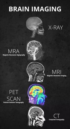 an image of the brain and its functions in different areas of the human body, including mri