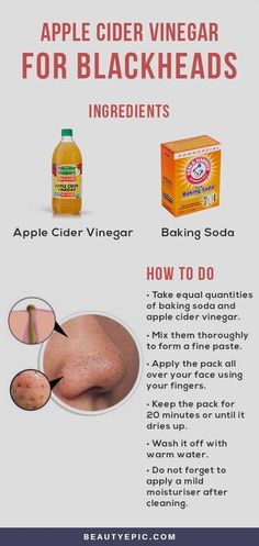 For Blackheads, Rid Of Blackheads, Canned Apples, Apple Vinegar, Organic Apple Cider, Get Rid Of Blackheads, Blackhead Remover, Cider Vinegar, Belleza Natural