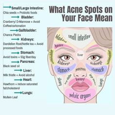 The Home Doctor on Instagram: ". . . #homedoctor #homedoctorbook #secretremedies #healthy #dailytipshealth" Food For Acne, Probiotic Foods, Home Doctor, Large Intestine, Acne Spots, Improve Health, Health Facts, Body Health