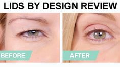 Big Round Mirror, Picket Fence Panels, Eyelid Lift, Eyelid Tape, State Of Play, Excess Skin, Eye Lift, Natural Contour, Eye Contour