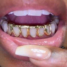 a close up of a person's mouth with gold teeth and braces on it