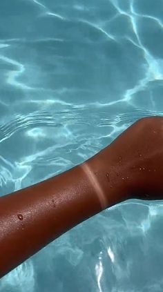 a person's arm in the water with sunburns on and under it