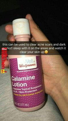 xbrattt 🥀🥵 Obličejové Masky, Calamine Lotion, Acne Scar, Clear Acne, Skin Tips, Facial Care, Face Care, Hair Skin