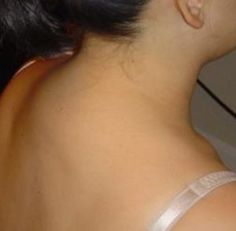 the back of a woman's head with no hair