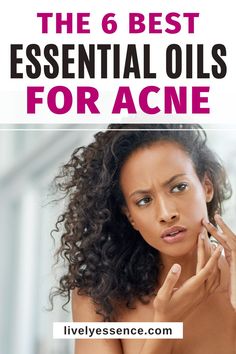 The best essential oils for acne are listed here. They're not only effective at reducing the severity of your breakouts, but also help reduce redness and inflammation to give you clear skin! #essentialoils #acne Essential Oils For Acne, Oils For Acne, Juniper Berry Essential Oil, Oregano Essential Oil, List Of Essential Oils, Mint Oil, Bergamot Essential Oil, Diy Remedies, Frankincense Essential Oil