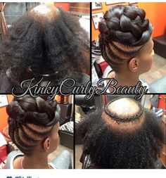 Amazing Hairstyles For Black Women With Alopecia, Crochet Braids For Alopecia, Braids For Women With Alopecia, Locs With Alopecia, Traction Alopecia Hairstyles, Silver Fox Hair, Coiling Natural Hair, Quick Weave Hairstyles